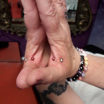 Implant transdermique par Dermogenese Tattoo