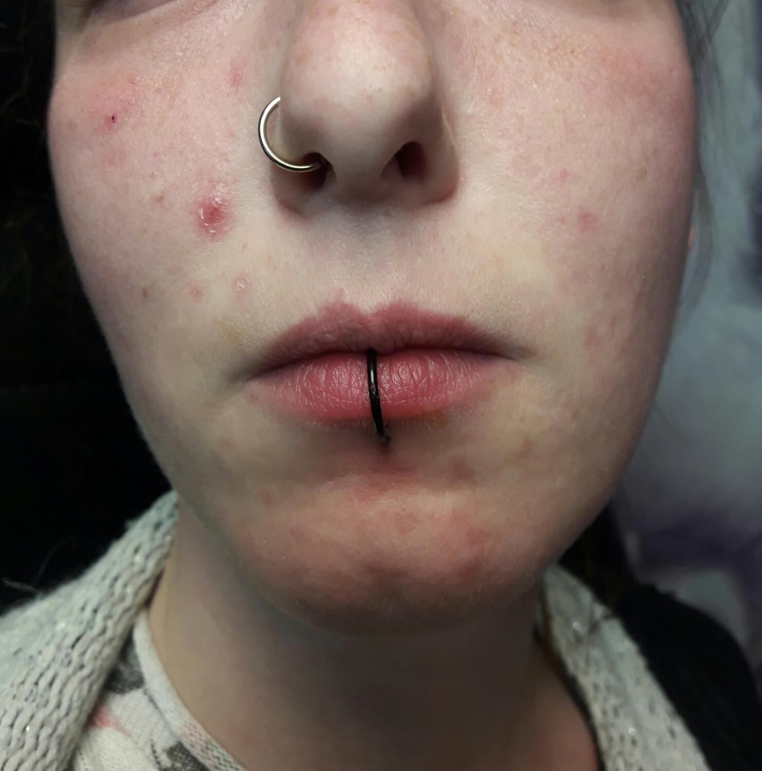 piercing par Dermogenese Tattoo piercing par Dermogenese Tattoo