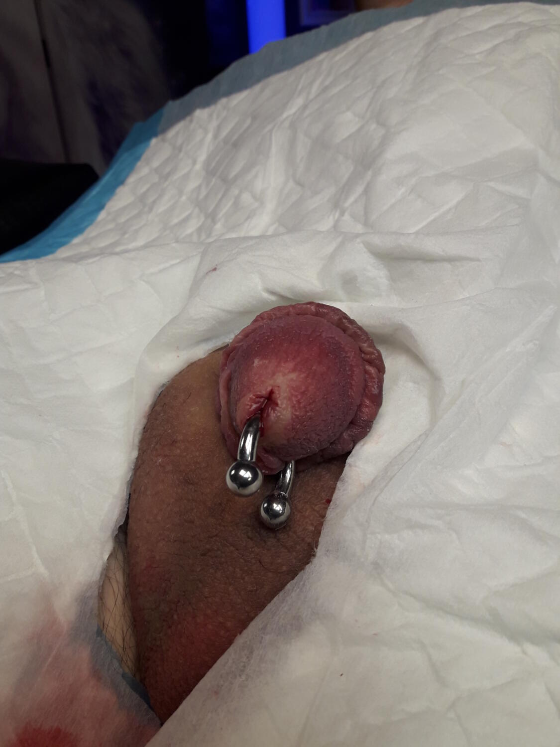 piercing Prince Albert par Dermogenese Tattoo piercing Prince Albert par Dermogenese Tattoo