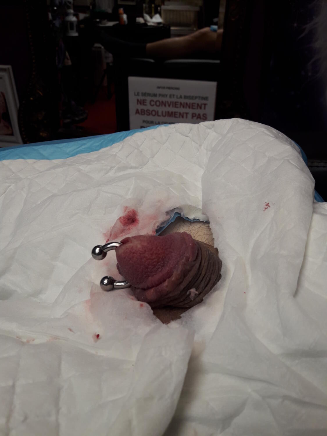 piercing Prince Albert par Dermogenese Tattoo piercing Prince Albert par Dermogenese Tattoo