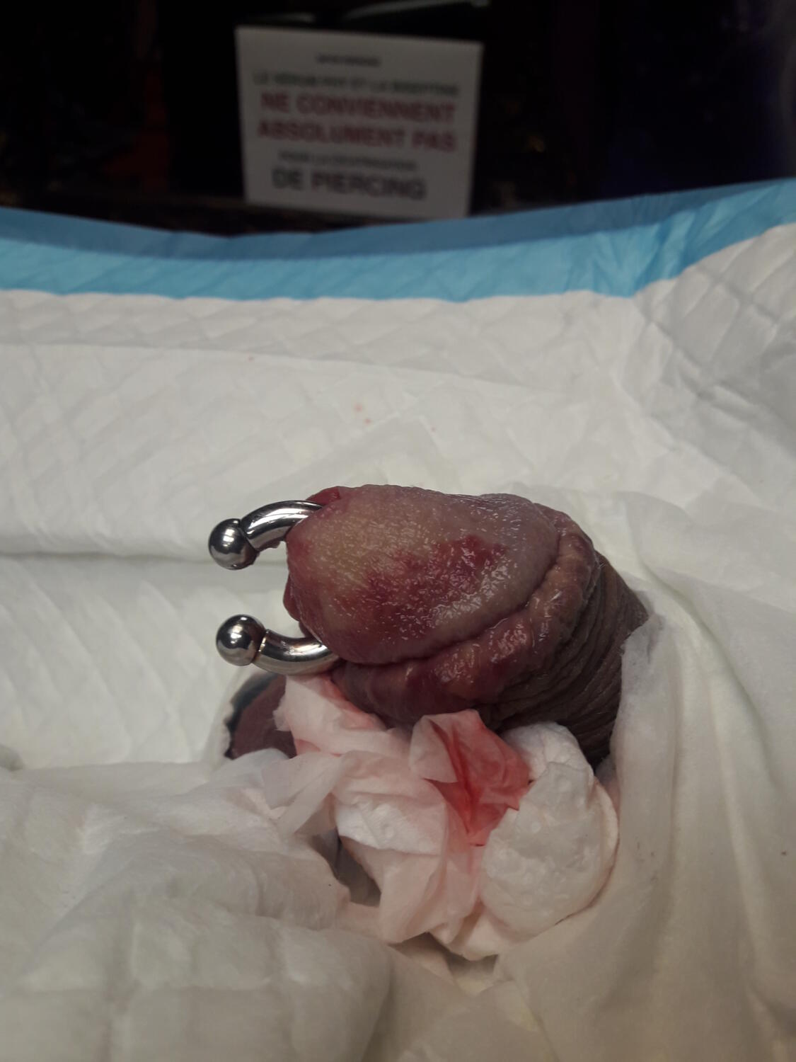 piercing Prince Albert par Dermogenese Tattoo piercing Prince Albert par Dermogenese Tattoo