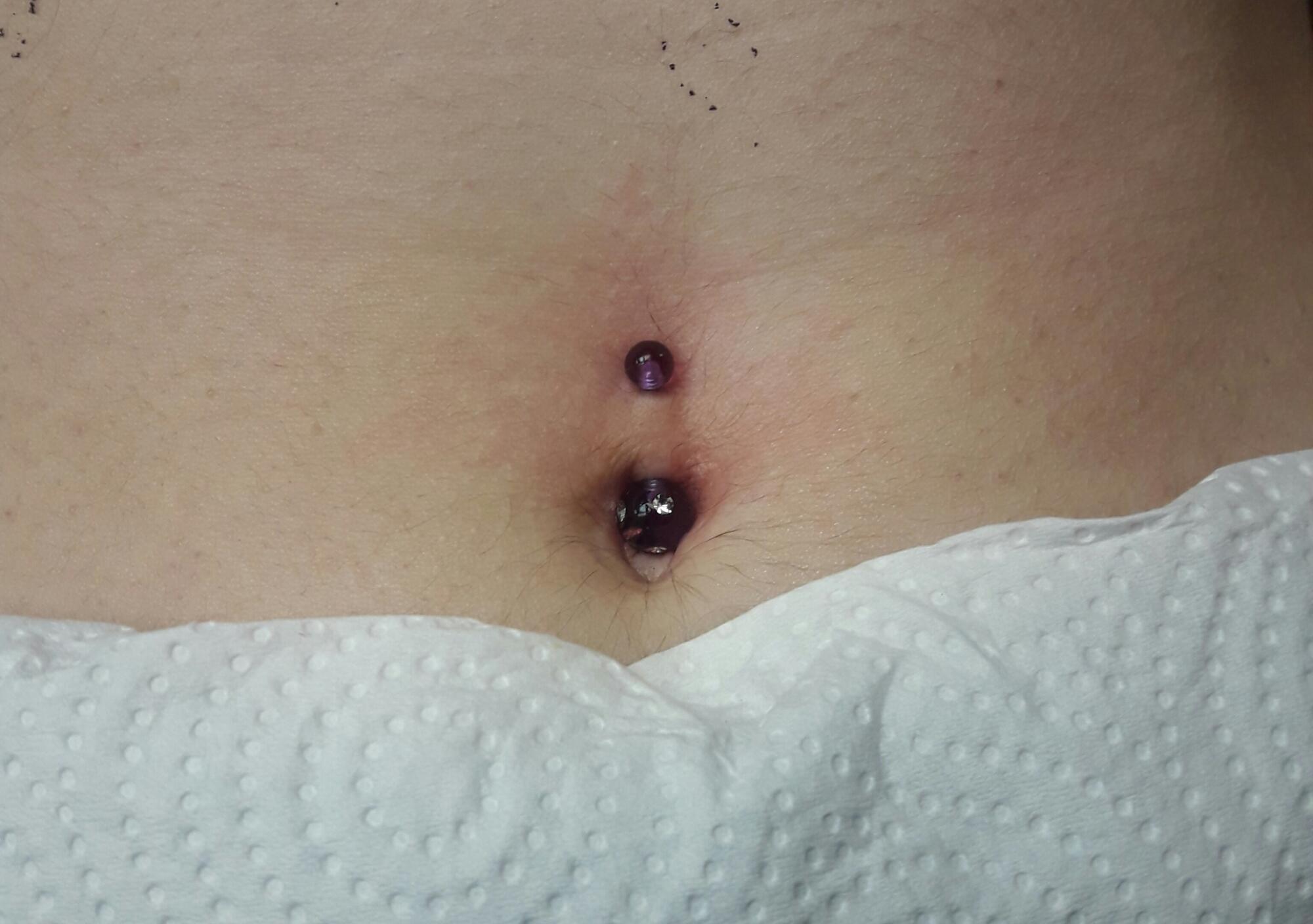 piercing au nombril par Dermogenese Tattoo piercing au nombril par Dermogenese Tattoo